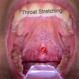 Throat Stretching